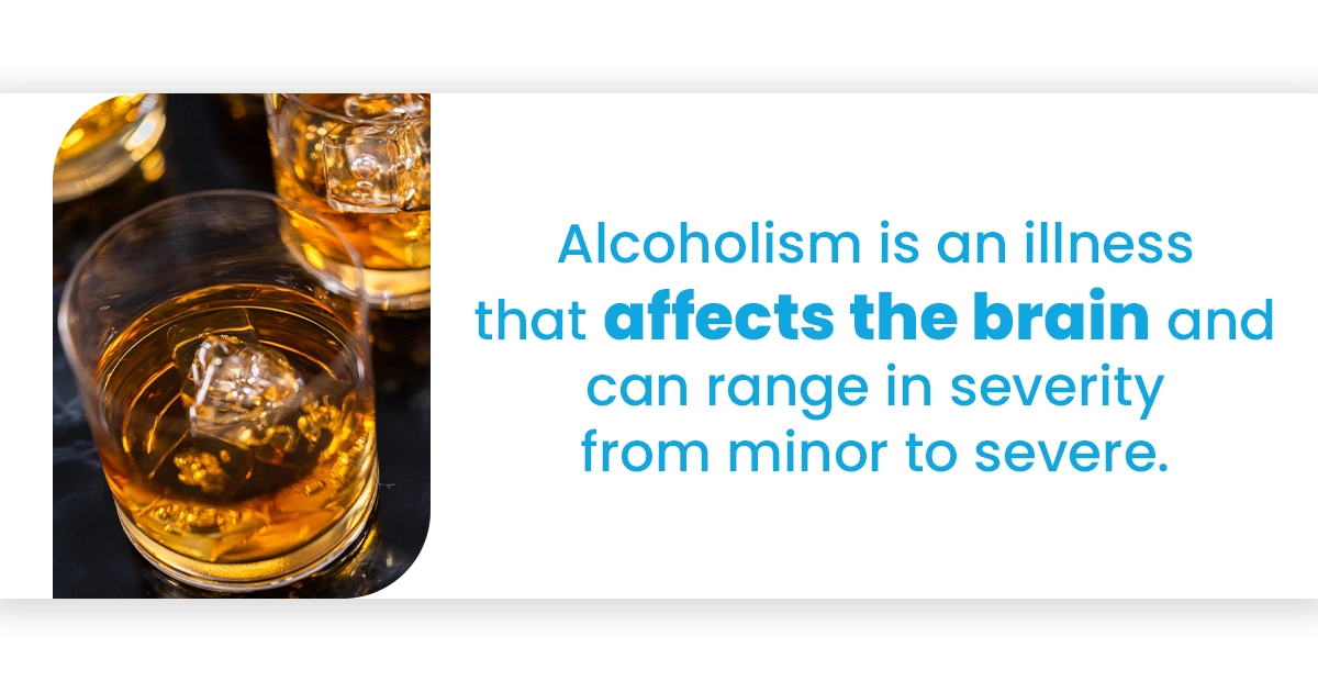 Image showing factors that are responsible for developing an alcohol use disorder
