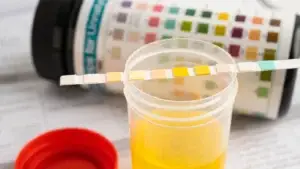Testing Meth in the Urine