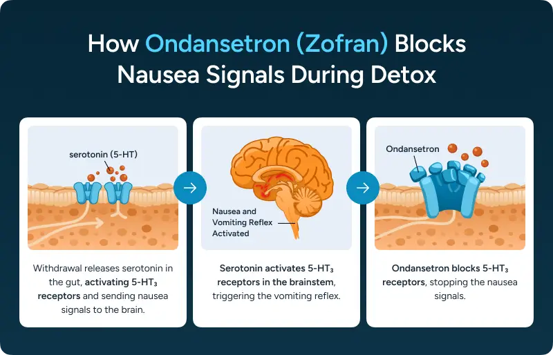How Ondansetron (Zofran) Blocks Nausea Signals During Detox