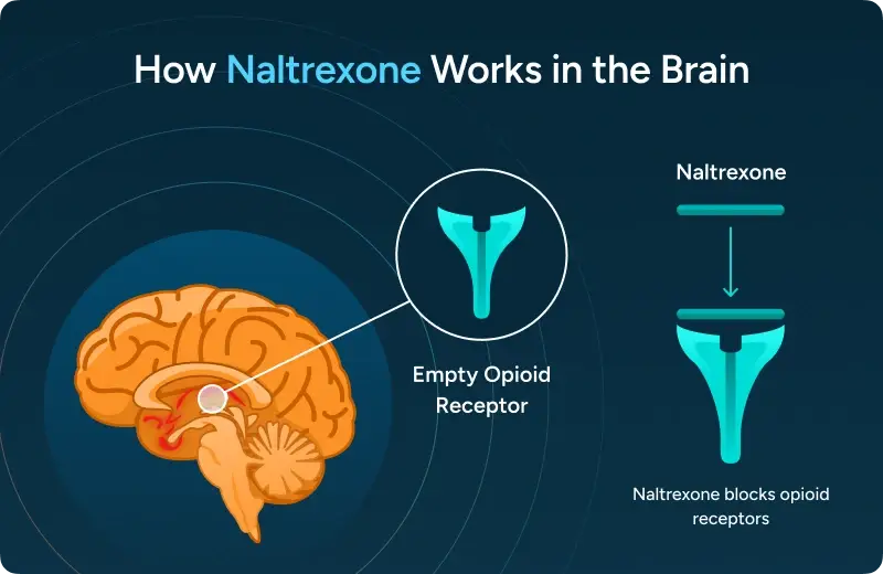 How Naltrexone works