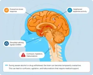 During severe alcohol or drug withdrawal, the brain can become temporarily overactive. This can lead to confusion, agitation, and hallucinations that require medical support.