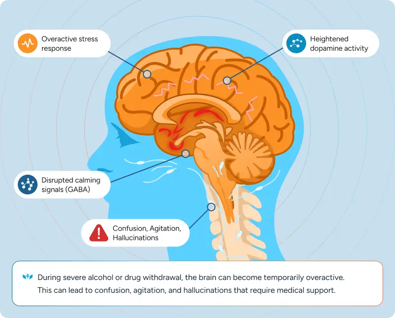 During severe alcohol or drug withdrawal, the brain can become temporarily overactive. This can lead to confusion, agitation, and hallucinations that require medical support.