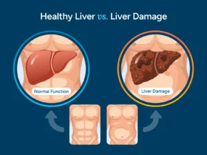 Healthy Liver vs. Liver Damage
