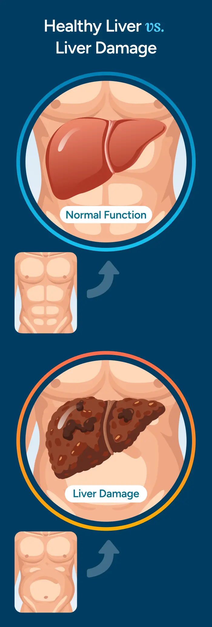 Healthy Liver vs. Liver Damage