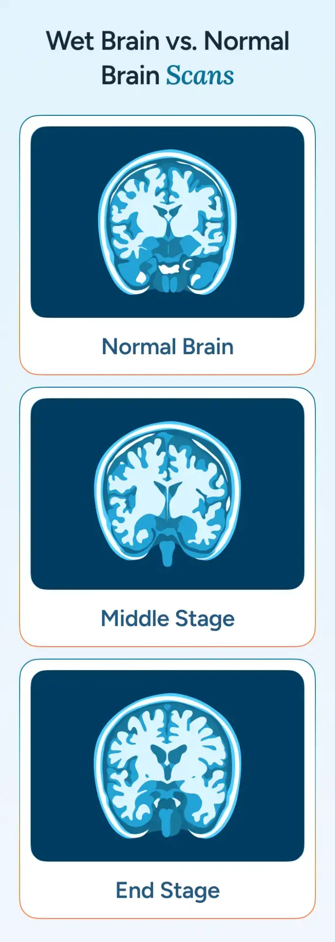 Wet Brain vs. Normal Brain Scans