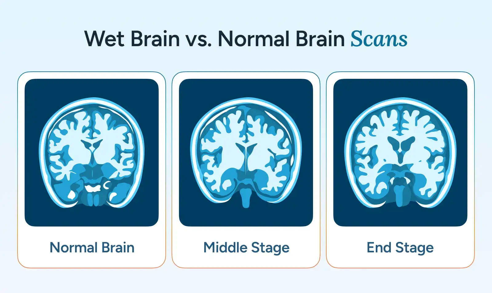 Wet Brain vs. Normal Brain Scans